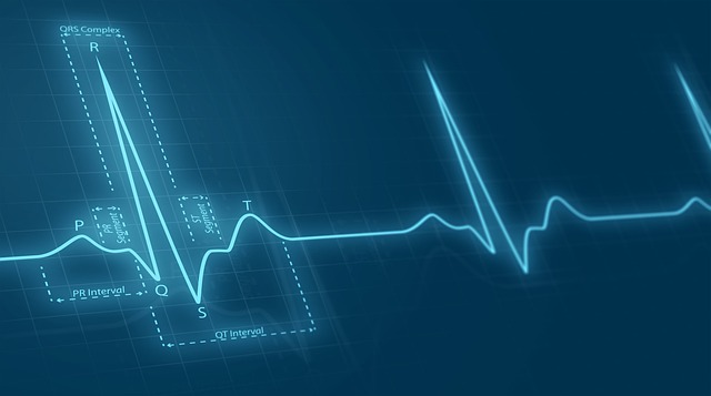 Cardia pulse Image by romnyyepez from Pixabay